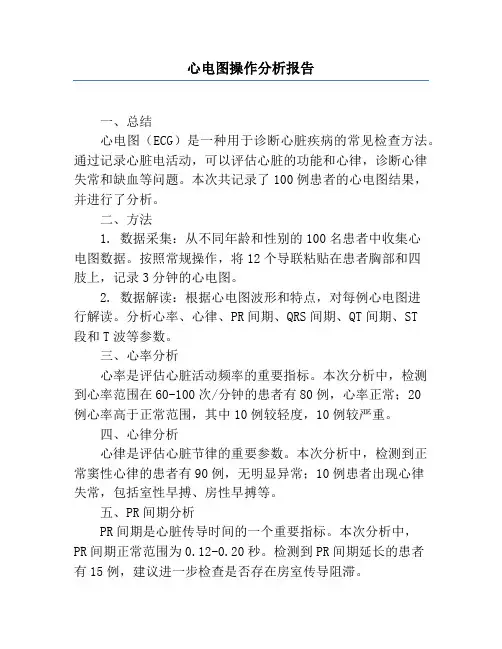 心电图操作分析报告