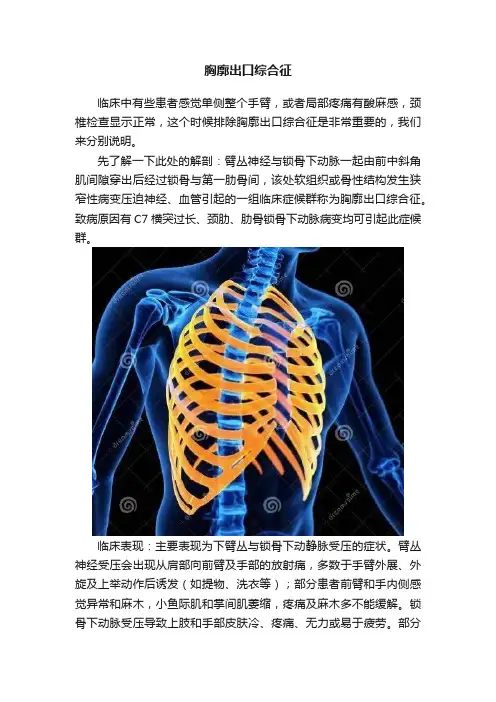 胸廓出口综合征