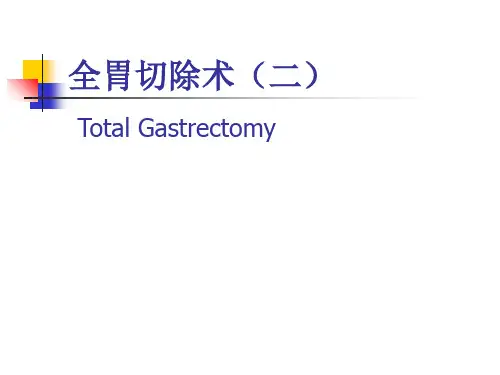 图解全胃切除术