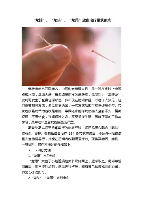 “龙眼”、“龙头”、“龙尾”放血治疗带状疱疹