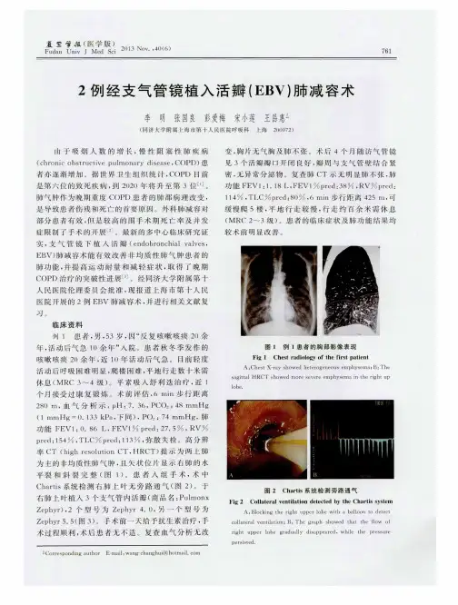 2例经支气管镜植入活瓣(EBV)肺减容术