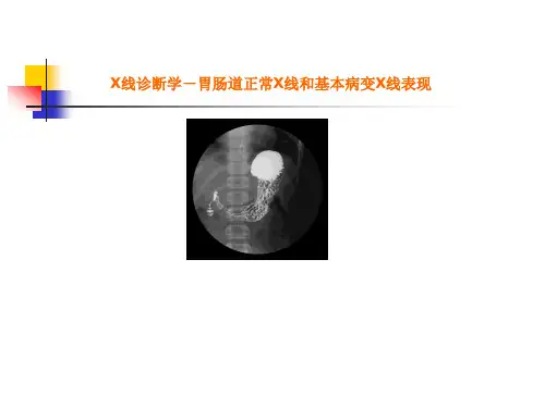 最新 胃肠道正常X线和基本病变X线表现(80页)