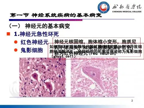 病理学 第14章.神经系统 第7版
