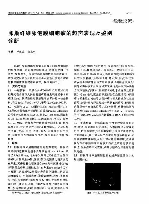卵巢纤维卵泡膜细胞瘤的超声表现及鉴别诊断