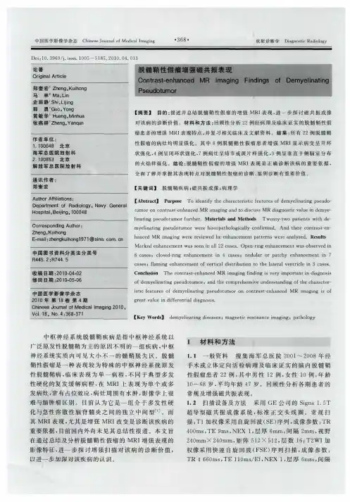 脱髓鞘性假瘤增强磁共振表现