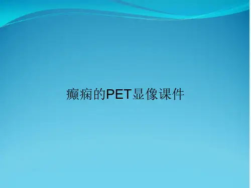 癫痫的PET显像课件
