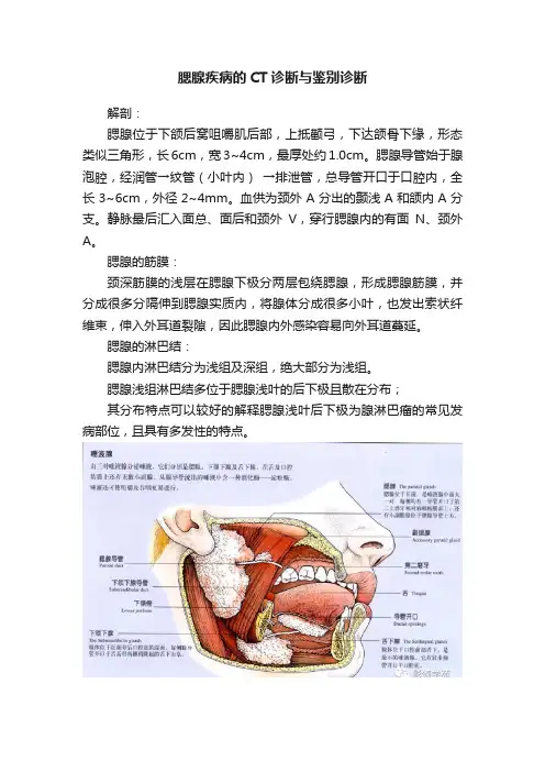 腮腺疾病的CT诊断与鉴别诊断