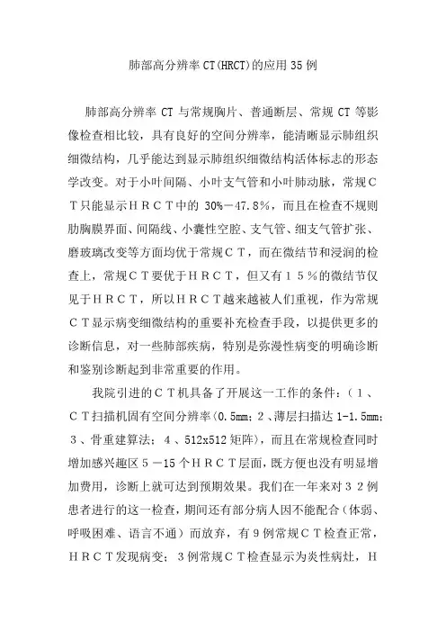 肺部高分辨率CT