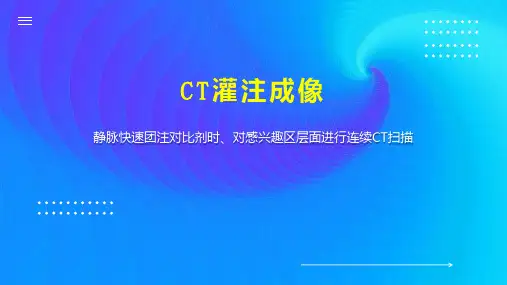 CT灌注成像