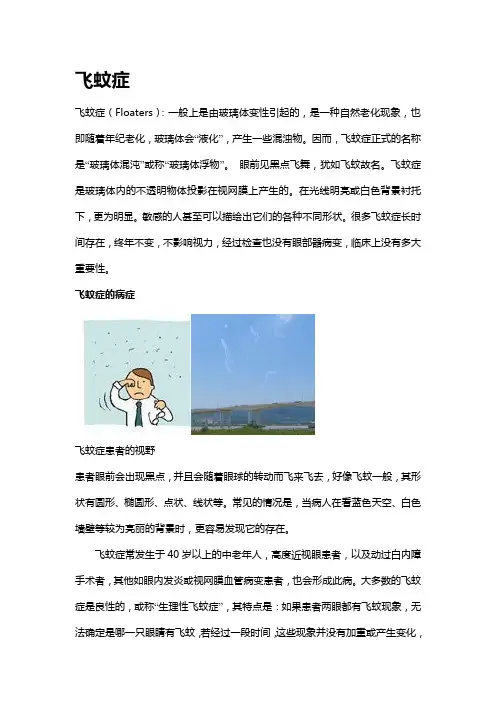 飞蚊症