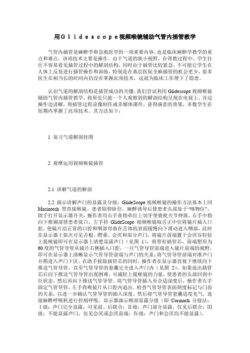 用Glidescope视频喉镜辅助气管内插管教学