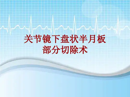 手术讲解模板：关节镜下盘状半月板部分切除术