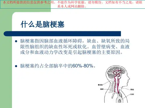 急性脑梗塞的溶栓治疗业务学习培训课件