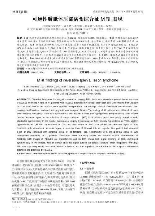 可逆性胼胝体压部病变综合征MRI表现