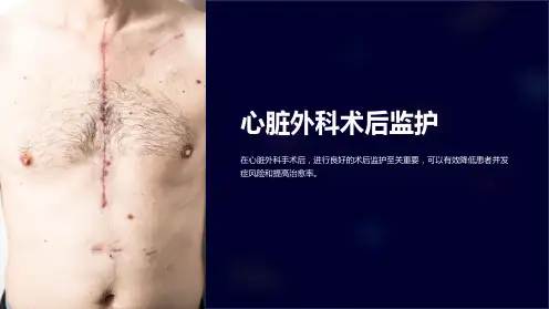 心脏外科术后监护