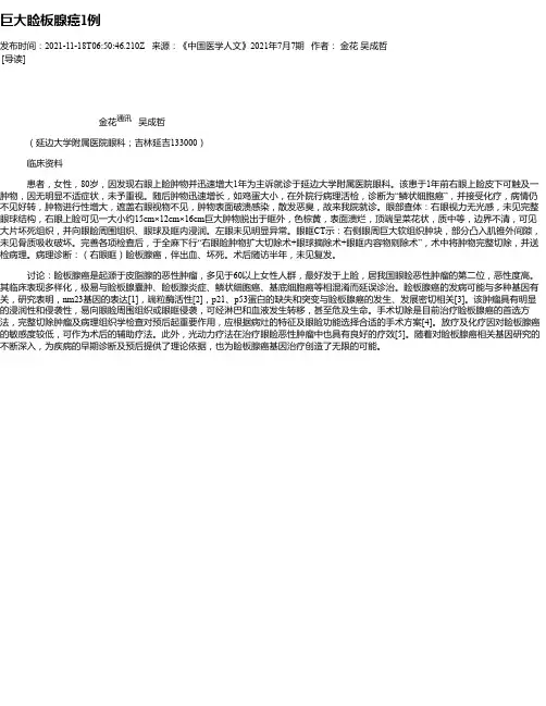 巨大睑板腺癌1例