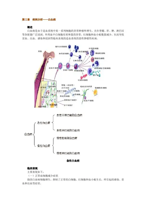 第三章 病例分析——白血病