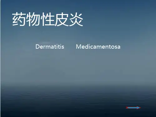 《皮肤性病学》药物性皮炎 ppt课件