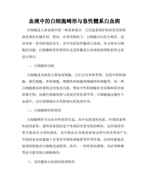 血液中的白细胞畸形与急性髓系白血病