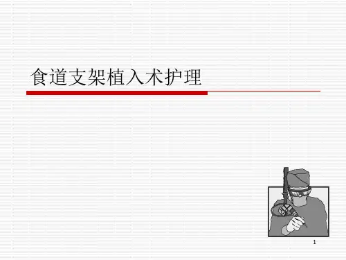 食道支架ppt课件