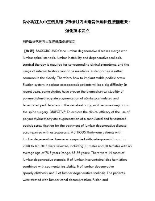 骨水泥注入中空侧孔椎弓根螺钉内固定骨质疏松性腰椎退变：强化技术要点