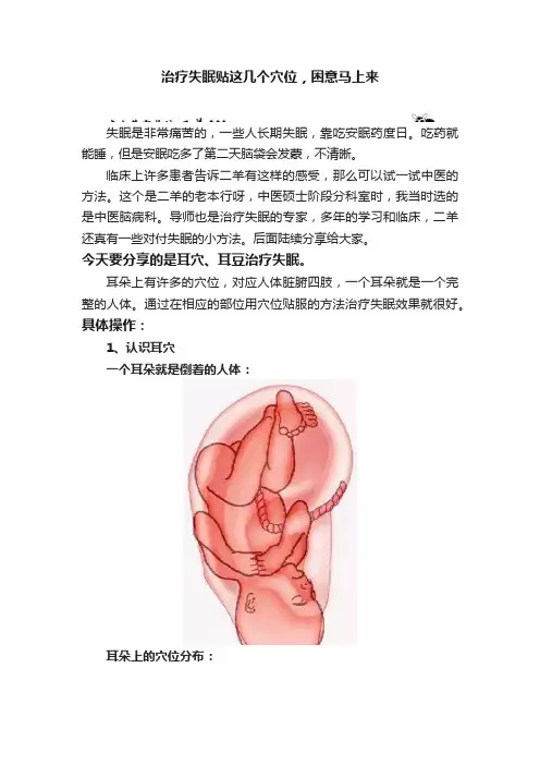 治疗失眠贴这几个穴位，困意马上来