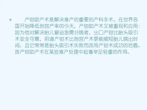 产钳助产术医学