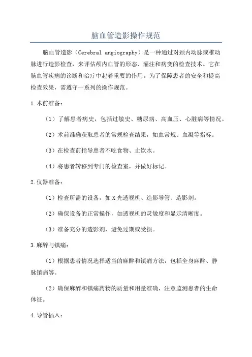 脑血管造影操作规范