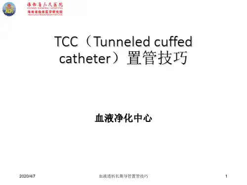 血液透析长期导管置管技巧