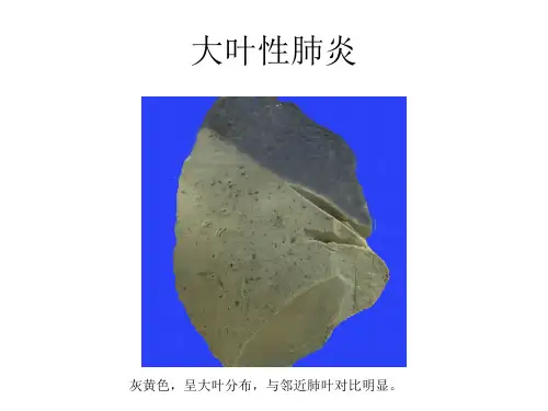 病理学-呼吸系统疾病
