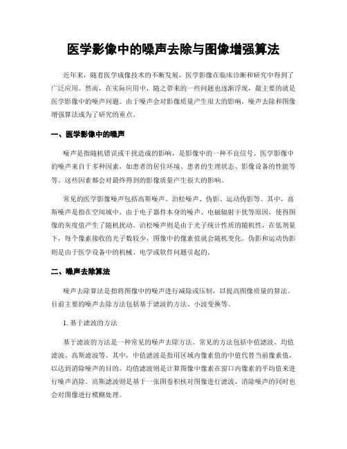 医学影像中的噪声去除与图像增强算法