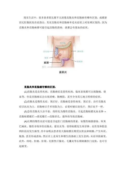 直肠炎和直肠癌有哪些区别