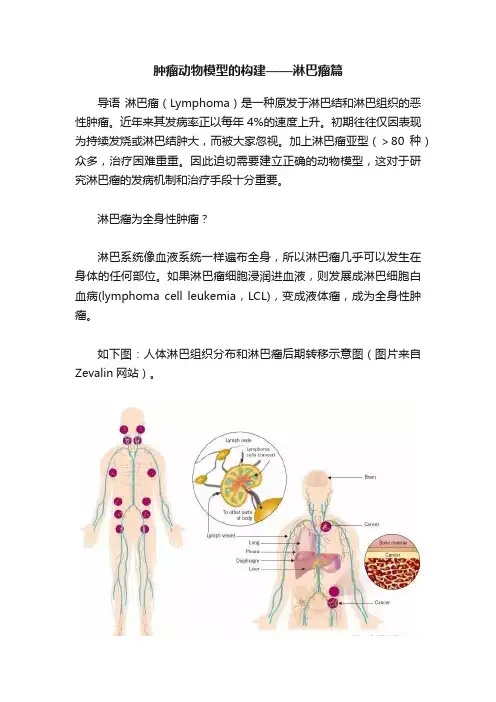 肿瘤动物模型的构建——淋巴瘤篇