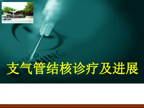 支气管结核诊疗及进展