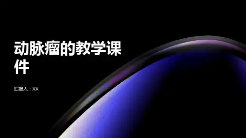 动脉瘤的教学课件