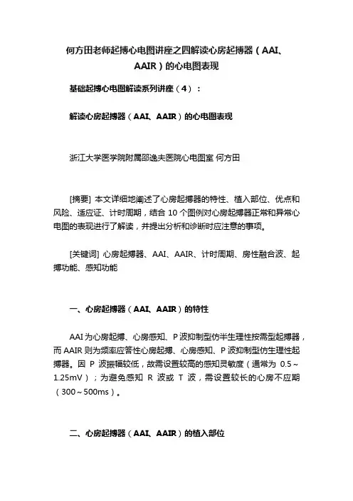 何方田老师起搏心电图讲座之四解读心房起搏器（AAI、AAIR）的心电图表现