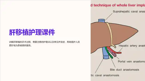 肝移植护理课件