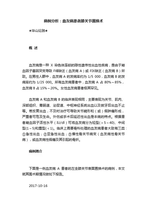 病例分析：血友病患者膝关节置换术