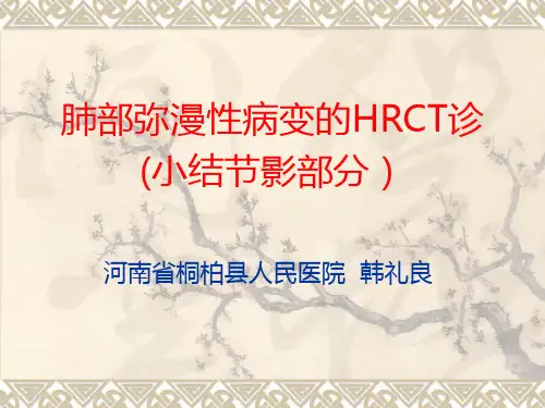 肺部弥漫性病变的HRCT诊断(小结节影部分)