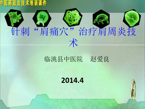 针刺肩痛穴治疗肩周炎技术PPT课件