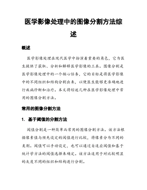 医学影像处理中的图像分割方法综述