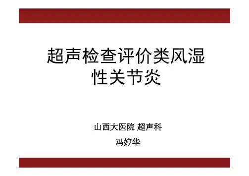 超声检查评价类风湿性关节炎