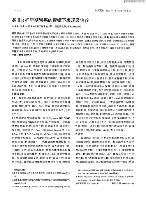 类ⅡB样早期胃癌的胃镜下表现及治疗