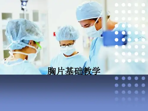 胸片基础ppt课件