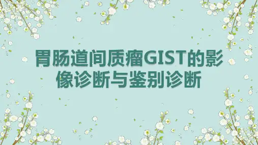 胃肠道间质瘤GIST的影像诊断与鉴别诊断