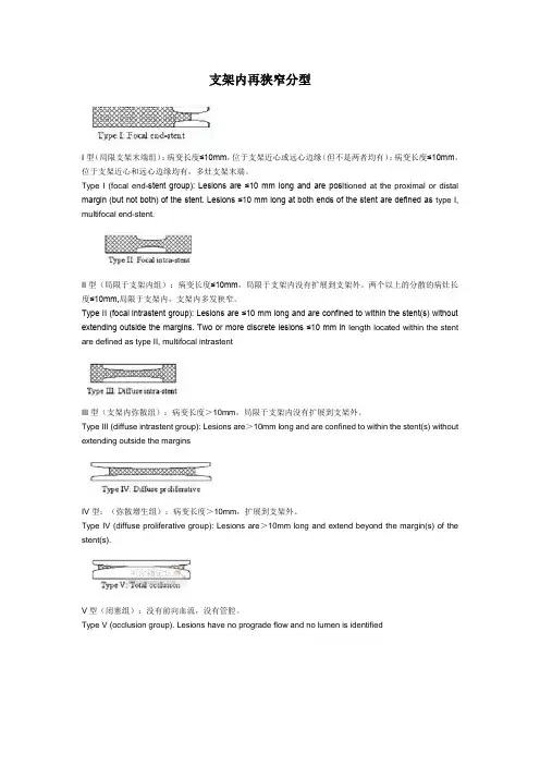 支架内再狭窄分型