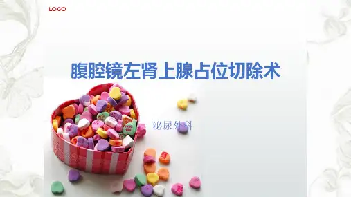 肾上腺占位切除术ppt课件