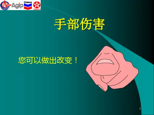 手部安全ppt课件
