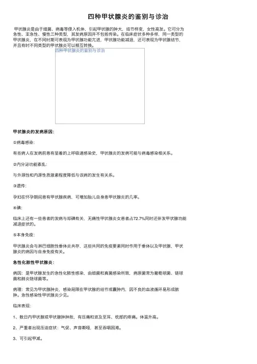 四种甲状腺炎的鉴别与诊治