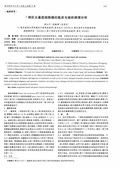 7例巨大基底细胞癌的临床与组织病理分析